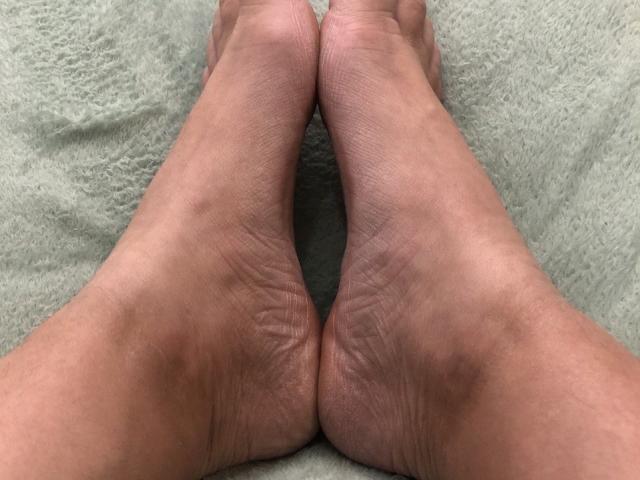 LadyMiller's soles, feet, and toes are in the center of the image, with her toes pointed upwards and feet slightly apart on a green textured surface.