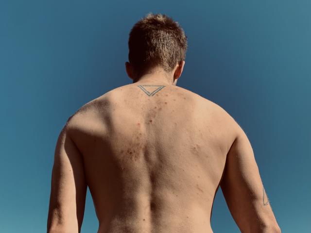 La schiena nuda di DagmarEtMirana, che mostra un piccolo tatuaggio a forma di triangolo sulla parte superiore della colonna vertebrale, con imperfezioni cutanee visibili, capelli castani corti e uno sfondo di cielo blu limpido..
