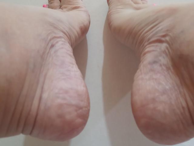 Le piante dei piedi di Loretta Sanchez, segnate da rughe e con vene visibili, e con unghie dei piedi rosa, sono posizionate una accanto all'altra, mostrando la parte inferiore dei piedi in una ripresa dal basso..