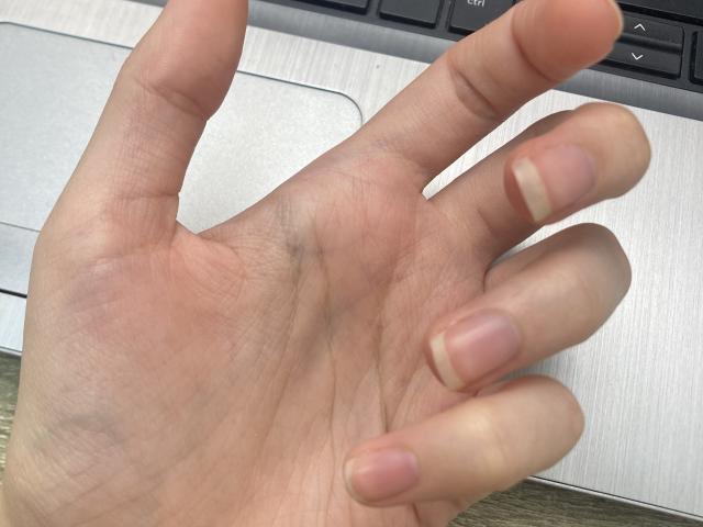 ImAmelie - Live porn &amp; sex cam - 18141162