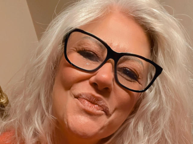 CrazyBionda, con cabello blanco, gafas negras y una ligera sonrisa, mostrando arrugas y un labio inferior hinchado, vestida con una blusa naranja, tiene un rostro lindo, de persona mayor y atractivo..