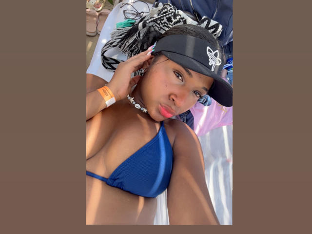 MelanyScoth with brown skin, wearing a black NY Yankees cap, blue bikini top, orange wristband, and black choker, lying on a white towel, looking at the camera.
