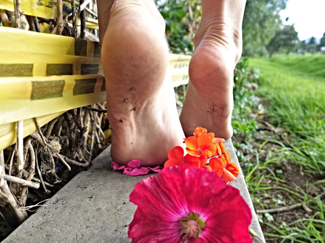 As solas dos pés da SelenaRogue com pequenas secreções, os pés apoiados em um parapeito de concreto, flores rosa e laranja, um banco amarelo e um campo gramado ao fundo..