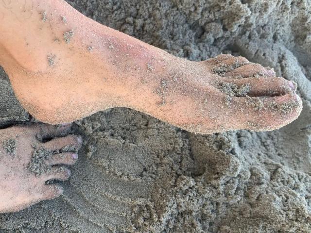Os pés sujos de Vivienne Laurent e o pé coberto de areia, com parte do pé e dos dedos visíveis ao fundo, em uma superfície de praia áspera e texturizada..