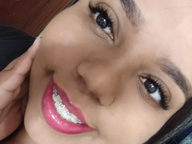 El rostro de Sarah Smity, mostrando labios rosados y brillantes, dientes blancos con brackets plateados y ojos oscuros con pestañas largas. Ella está tocándose la mejilla con una mano..