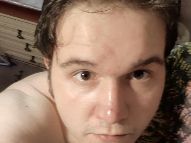 NectarineFad has a pale, slightly sweaty face with brown eyes, light brown hair, and a small nose. He's shirtless, showing a bit of his shoulder.