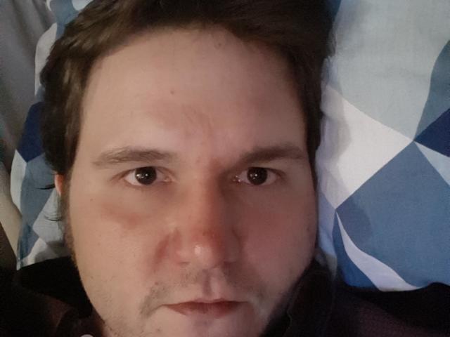 NectarineFad's face, showing a slightly red nose and brown eyes, lying on a blue and white patterned pillow with short brown hair and a small goatee.