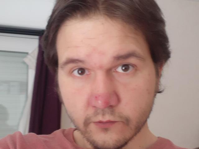 NectarineFad has a red nose, brown eyes, and a brown beard. He's wearing a pink shirt with his hair down, looking at the camera with a serious expression.
