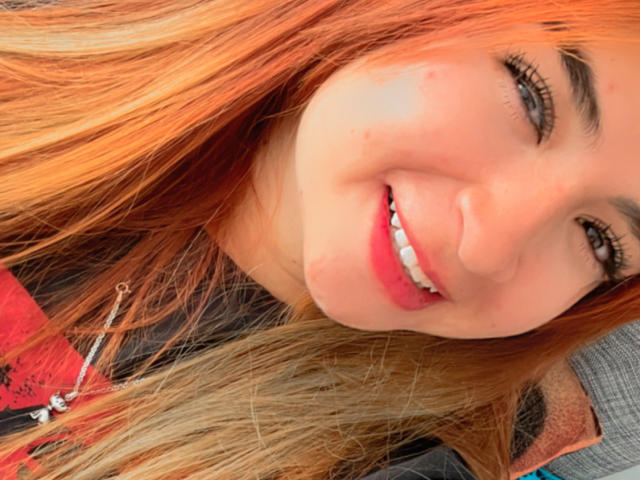 MyAmelie - Live porn &amp; sex cam - 20521522