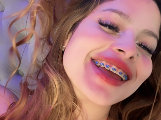 ShantalSummer with her pinkish skin, brown wavy hair, nose ring, and blue floral braces, smiling with red lipstick.