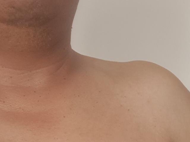 L'épaule nue et le haut du torse de MikeCool, avec des marques de bronzage visibles, de légères taches de rousseur et un teint brun clair lisse. Son cou est partiellement visible sur la gauche..