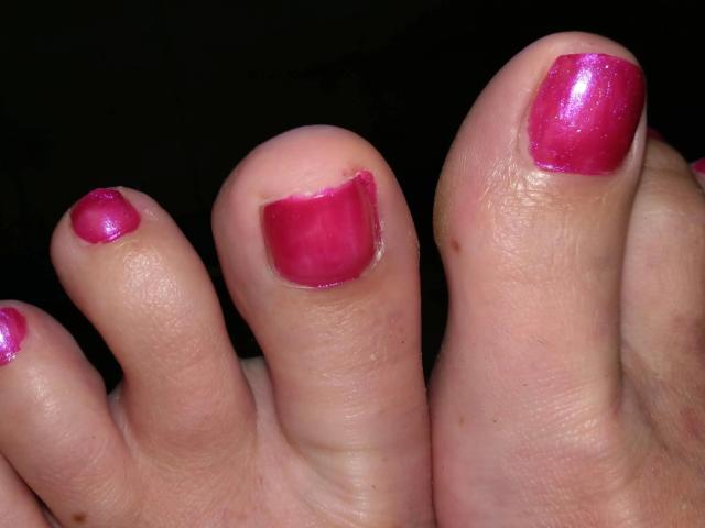 MissShine-hot's toes have shiny pink nail polish, with one toe's nail slightly chipped. Her skin is light and the toes are positioned against a dark background.