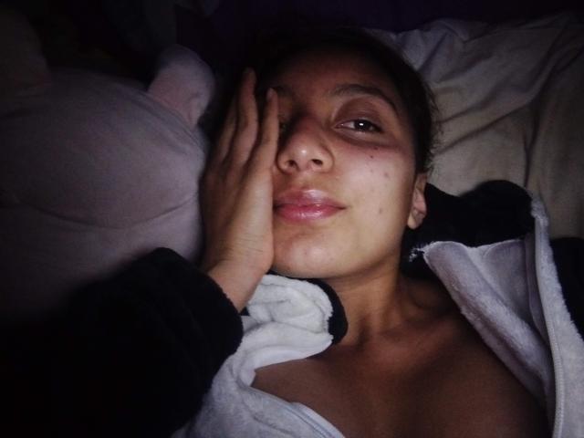 DianaFernandezz lying in bed, face slightly flushed, hand on forehead, pouty lips, dark brown hair, light brown skin, wearing a black and white zip-up hoodie, eyes half-open.