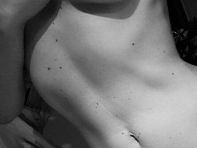 Black-and-white photo of FullMoon69's bare, flat, slightly curvy stomach with small, dark moles scattered across the skin. Visible navel, no clothes, right arm partially in frame.