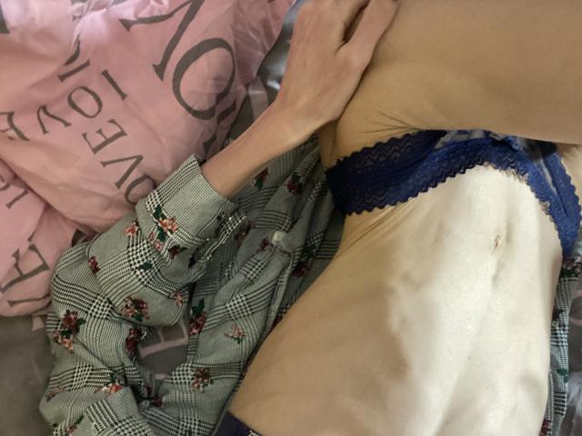 O corpo magro e pálido de Kabblasha, usando uma calcinha de renda azul, com a mão na coxa, vestindo uma camisa xadrez aberta com estampas florais, está deitada em uma cama. É visível o umbigo e as costelas..