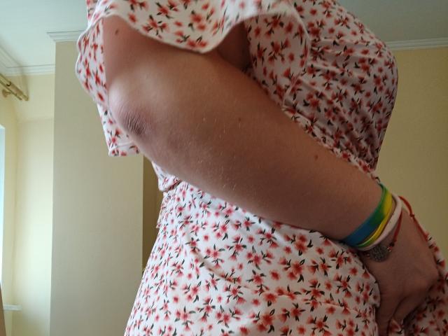 Leiliia's arm in a floral dress, showing her armpit with slight sweat, wearing colorful bracelets on her right wrist, photographed from a low angle.