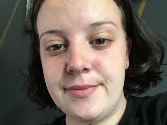 KekeHot's face, showing pale skin, brown eyes, short dark hair, slight smile, and small nose, wearing a black shirt, with a few blemishes and a slight pout.