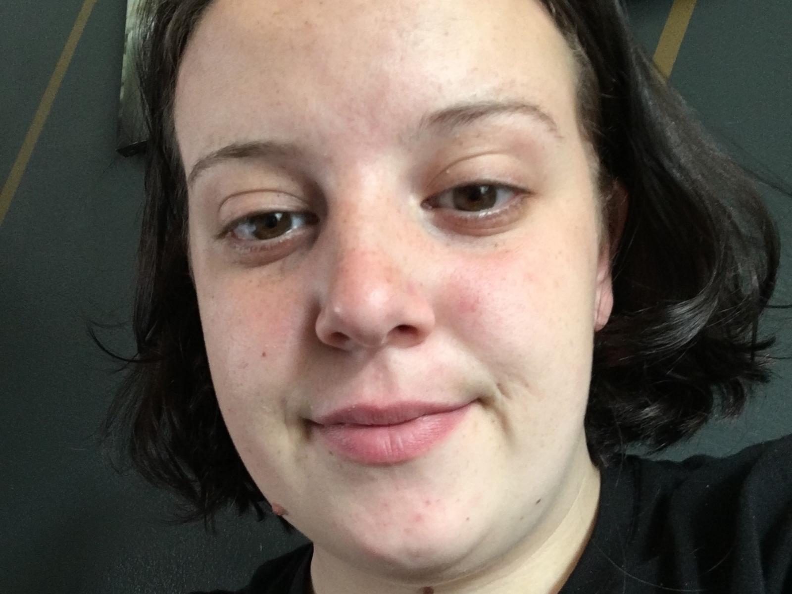KekeHot's face, showing pale skin, brown eyes, short dark hair, slight smile, and small nose, wearing a black shirt, with a few blemishes and a slight pout.
