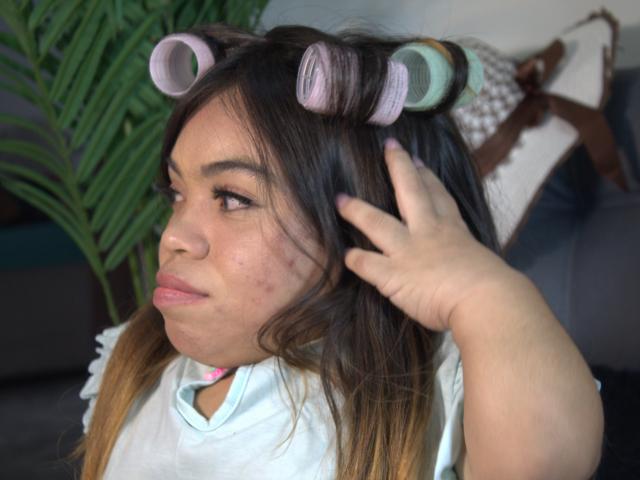 MichelleBrooks has pink and green hair rollers in her brown hair, a puffy face with acne, and is being touched on the side by her hand. She's wearing a white shirt.