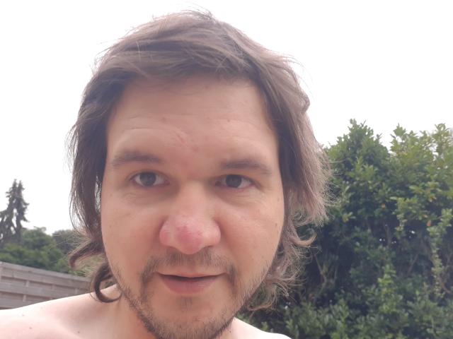NectarineFad has a nose with a noticeable red bump, medium-length brown hair, and a light beard. Shirtless, with green trees in the background.