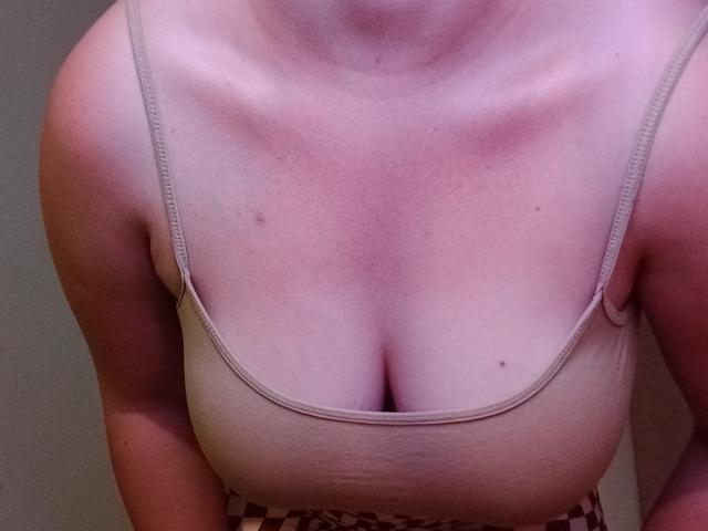 DiLaria's tits are showing in a beige, low-cut tank top, with a pinkish, sunburned chest and a few small moles, arms slightly bent.