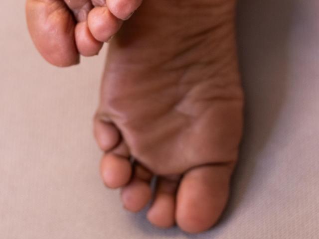 Anthoanelas schmutziger Fuß mit sichtbaren Falten und leicht gekrümmten Zehen, gehalten von ihrer anderen Hand. Ihre Haut ist braun und ihre Zehen sind leicht verschmutzt..