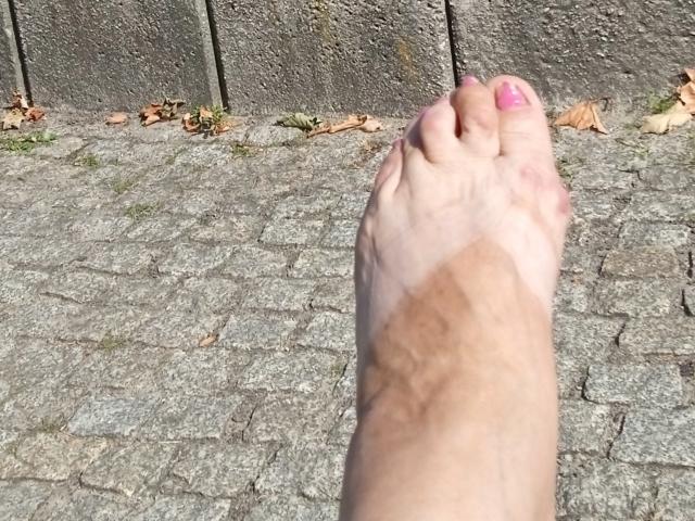 MioritaStar's bare foot with pink-painted toenails, slightly bruised and showing a large tan mark, standing on a cobblestone surface.