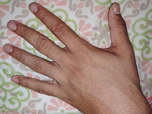 Jorzo's hand is an open, slightly hairy, medium-toned, right-handed palm with visible knuckles and slightly curved fingers. The fingers are spread apart, showing the palm.