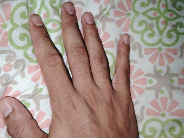 Jorzo's hand with slightly dirty fingers and visible hair on the palm, showing five fingers and light pink nail beds, resting on a patterned fabric.
