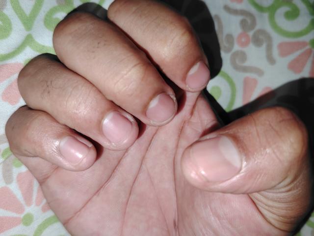 Jorzo's hand with slightly dirty, pale pink, slightly chipped fingernails, visible knuckle lines, and small calluses on the fingers, set against a patterned background.