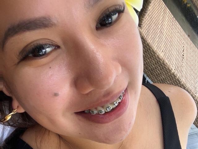 EmmaRose69 has a smile with metal teeth, light brown skin, dark eyebrows, and a small mole on her cheek, wearing a yellow hair clip and black top.