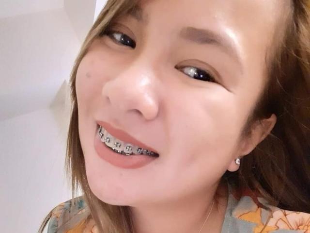 EmmaRose69 with a toothy grin, showing metal braces on her upper teeth. She's got light brown hair, slightly shiny skin, and small diamond earrings, wearing a colorful top.