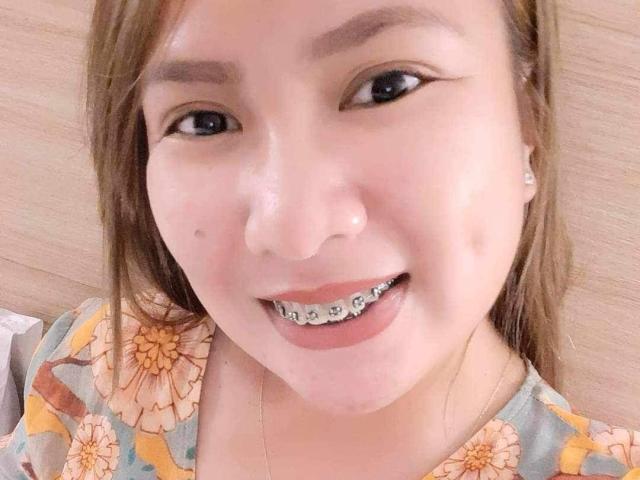 EmmaRose69 with a white, shiny substance on her face, smiling with metal braces on her teeth, wearing a floral shirt, light brown hair, and small diamond earrings.