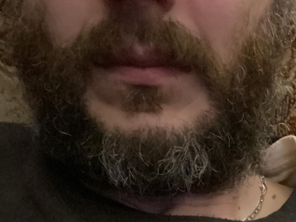 Het gezicht van Semoris, met een dikke, krullende bruine baard en snor, lichtroze lippen en een zichtbare gouden ketting in de rechteronderhoek. De afbeelding is onscherp..