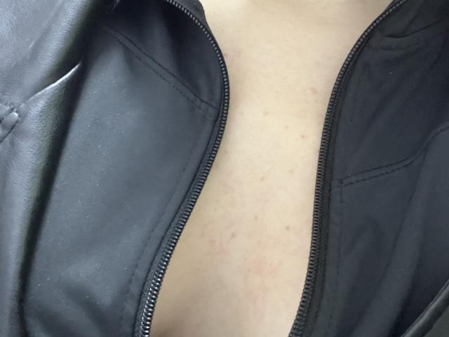 Il petto scoperto di Laliina, con piccoli e sparsi punti rossi e una pelle chiara, indossa una giacca di pelle nera con zip parzialmente aperta..