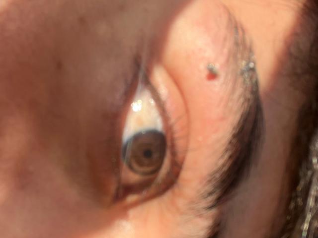 ImJuanda's eye, with a small red bump on the eyelid and a green speck near the brow, is centered in the image. The eye is slightly squinted.