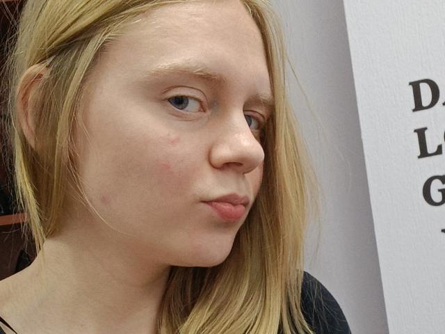 Laliina's face with blonde hair, pale skin, light blue eyes, small zits on her cheek, and slightly pouty lips, wearing a black top.