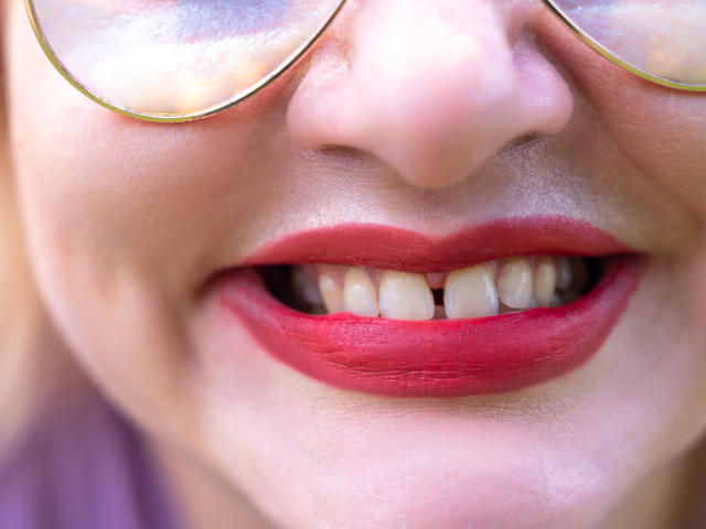 AngelinaGlam's face, focusing on her red lipstick, shiny white teeth, and gold-rimmed glasses, with a slight smile. Her skin is fair and she's wearing a purple top.