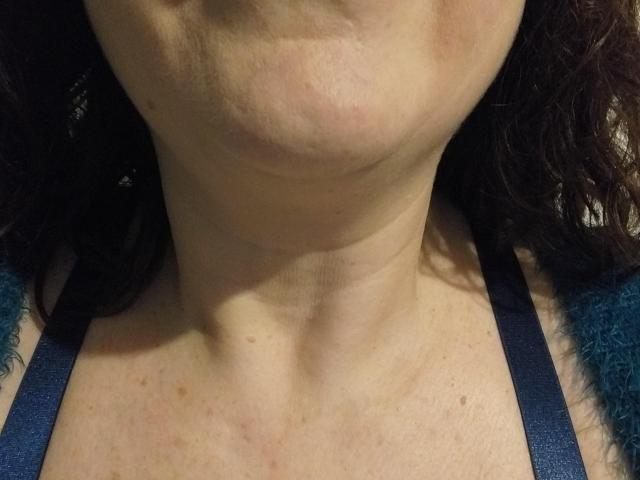 LiliChattePoilue's neck and upper chest, showing a visible Adam's apple, with a slightly prominent collarbone and a blue strap from a top. Her skin has light freckles.