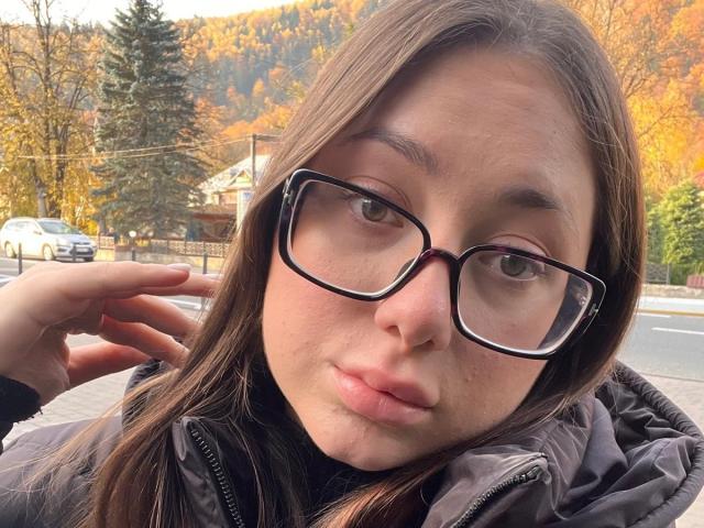 MayAlisa with puffy lips, brown eyes, and glasses, has a pouty expression, brown hair, and a black jacket, standing outside with a car and trees in the background.