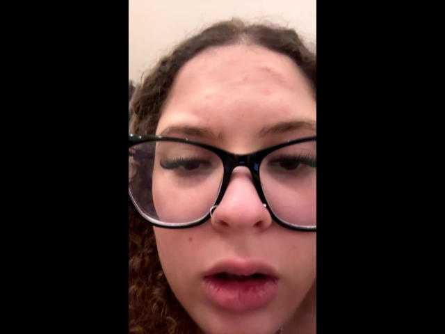 JuliaMartinsV's face with curly brown hair, wearing black glasses, has a pained expression, slightly open mouth, and visible red blemishes on her forehead.