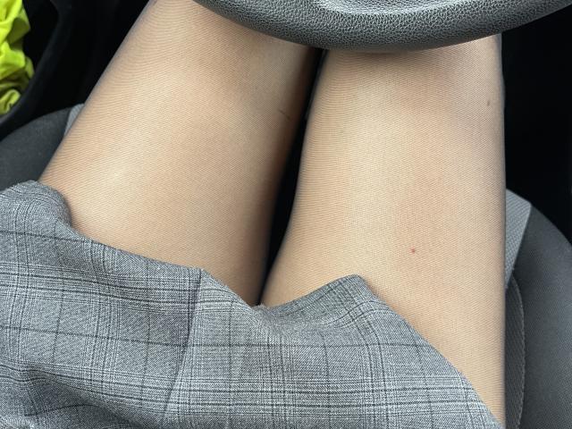 SandraSwweet's legs are in a car, showing her bare thighs with a gray, plaid skirt slightly lifted, revealing a small, dark mole on her right thigh.
