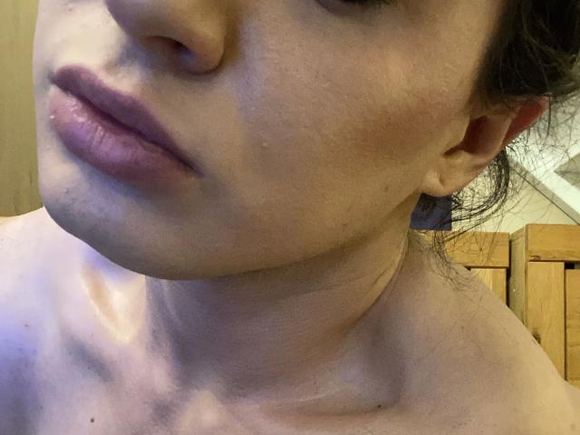 lolacarrera-hot's face, showing her slightly puffy pink lips, fair skin with small bumps, and dark hair, with her bare shoulders visible, in a casual, close-up shot.