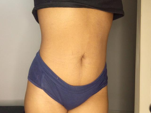MeganWlliams - Live porno og sexkamera - 25242465
