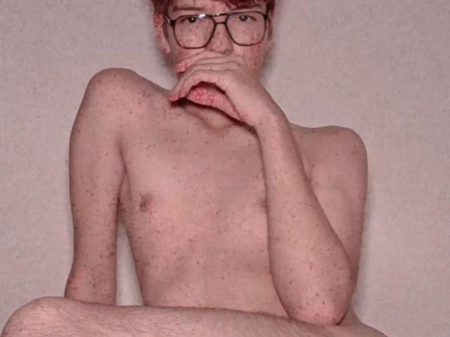 Naked CallMeSugar with freckles, red hair, and glasses, biting her finger, sitting with legs crossed, showing a flaccid, uncircumcised penis.