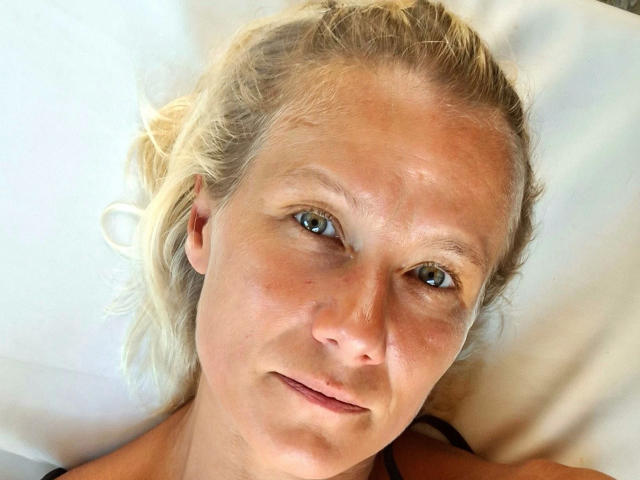 xcYola-hot has blonde hair, blue eyes, and a slight smile, lying on a white pillow, with a light skin tone and visible freckles, looking directly at the camera.