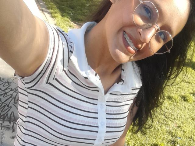 WorthyOfBdsm with glasses, smiling, showing metal teeth, wearing a striped white and black polo shirt, taking a selfie outdoors with green grass in the background.