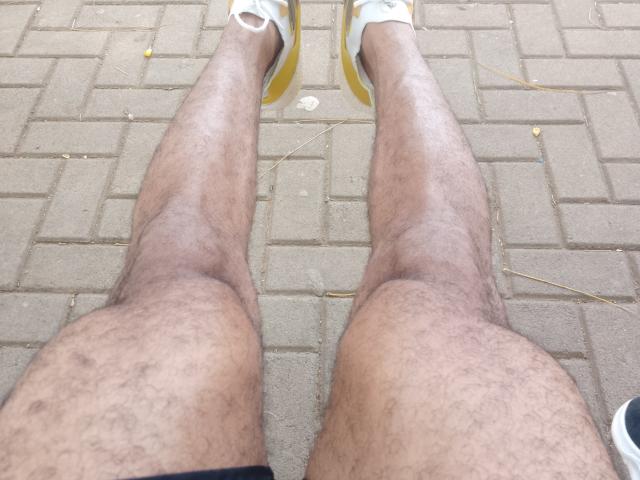 DereckStorm's hairy legs with a visible knee bruise, wearing white and yellow sneakers, standing on a brick-paved ground. His skin is tan and hairy, and he's wearing black shorts.