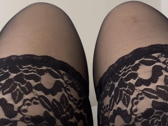 As pernas de AlinaMilf, com meias finas pretas com detalhes em renda, revelam suas coxas e uma pequena hematoma na perna direita. A renda tem um padrão floral, e a foto é um close-up..