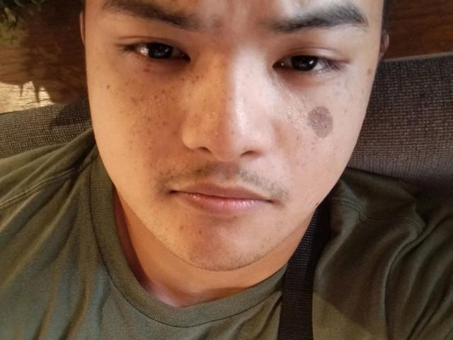AsianFuckboy-hot with a green shirt, freckled face, dark eyebrows, short black hair, small dark bruise on right cheek, looking slightly annoyed, seated on a gray fabric.